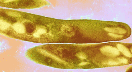 Image: Transmission electron micrograph (TEM) depicting the ultrastructural details displayed by a number of Gram-positive Mycobacterium tuberculosis bacilli (Photo courtesy of Science Source). Image: Transmission electron micrograph (TEM) depicting the ultrastructural details displayed by a number of Gram-positive Mycobacterium tuberculosis bacilli (Photo courtesy of Science Source).